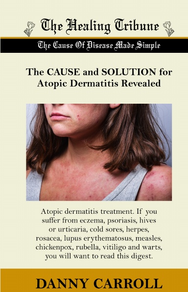 The Cause And Solution For Atopic Dermatitis Revealed Danny Carroll